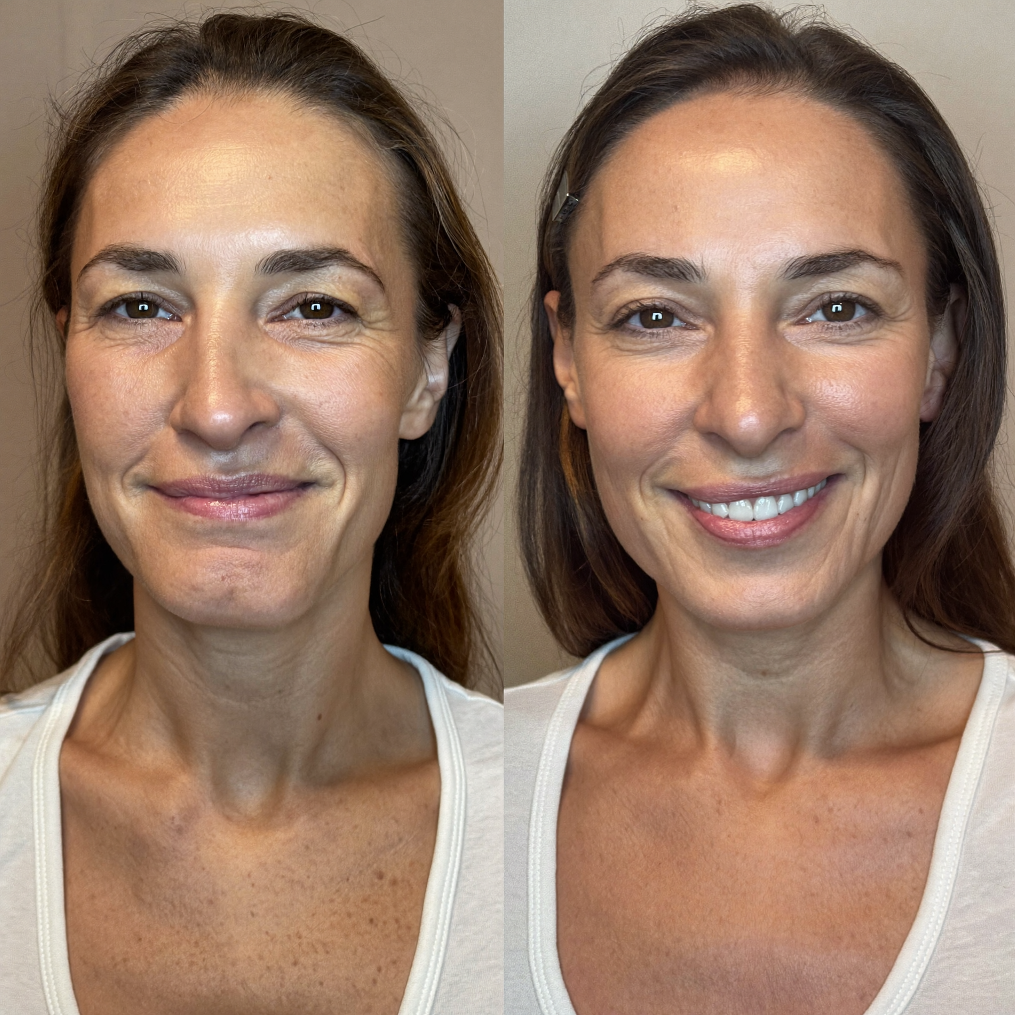 DermaLume - The Calm • Build • Restore Protocol